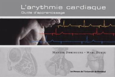 L'arythmie cardiaque. Guide d'apprentissage